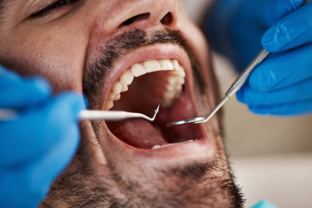 Best Dental Fillings (Composite and Amalgam)  in Roebling, NJ